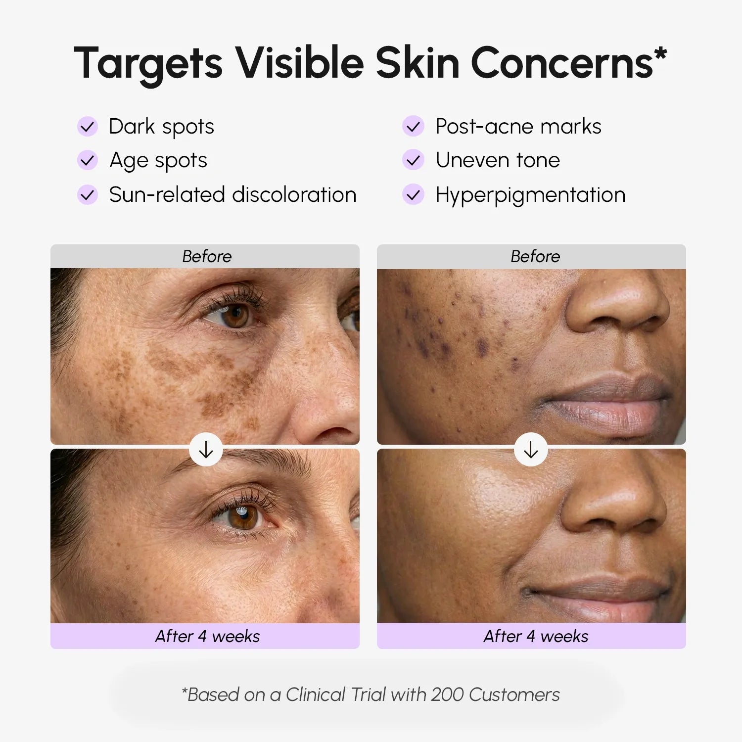 Dark Spot Eliminator